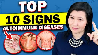 Top 10 Signs of Autoimmune Diseases  A Rheumatologists Guide [upl. by Linnet]