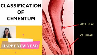 CEMENTUM  PART II II Classification of Cementum [upl. by Camp]