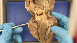 Sheep Heart and Model Anatomy Demo [upl. by Miru]