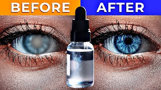 The Best Remedy For Cataracts [upl. by Russi]