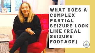 What does a Complex Partial Seizure Focal Impaired Awareness look like Real seizure footage [upl. by Wenn831]