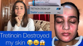 Quitting Tretinoin  Tretinoin destroyed my skin😭😫 [upl. by Spielman]