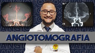 Angiotomografia e perfusão cerebral passo a passo [upl. by Minsat]