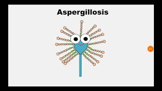 5 Aspergillosis [upl. by Agripina]