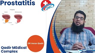 Prostatitis  Dr imran Qadir [upl. by Anu229]