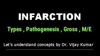 Infarction Pathology  Infarction Types  Infarction Morphology  Pathology Lectures [upl. by Beker719]