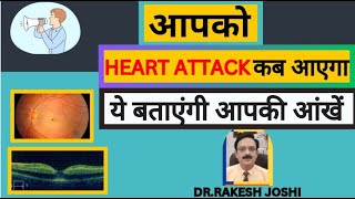 आपको HEART ATTACK कब आएगा ये बताएंगी आपकी आँखे [upl. by Esiouqrut]