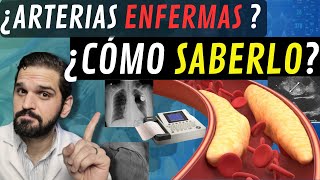 INTERESANTE¡ Exámenes para saber SI TENGO las ARTERIAS del corazón ENFERMAS 😲 [upl. by Bandur991]