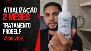 RESULTADO 2 MESES MINOXIDIL E DUTASTERIDA PROSELF [upl. by Chance855]