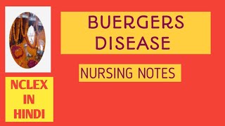 BUERGERS DISEASENURSING NOTESNCLEX IN HINDI [upl. by Anasxor]