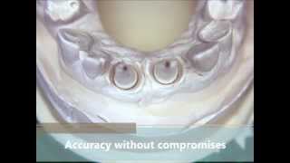 Accurate dental implant impression technique gingival retraction e4d cerec gcuff [upl. by Jarib]