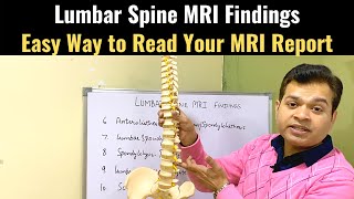 Lower Back MRI Learn to Read Your MRI report Slipped Disc MRI Lumbar Spine MRI Easy MRI reading [upl. by Yelik336]