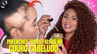 APENAS TRÊS INGREDIENTES O CABELO CRESCE MUITO E NÃO CAI NÃO USE MUITO [upl. by Nana818]