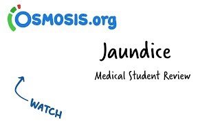 Jaundice  Clinical Presentation [upl. by Nnoved]