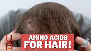 Amino Acids for Hair Growth  Do They Work [upl. by Craig]