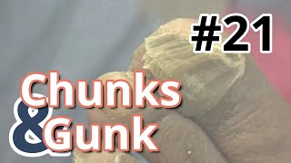 Chunks and Gunk 22 Another Big Toe 2023 [upl. by Ytirahc]