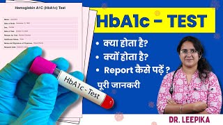 HbA1c Test Kya Hota Hai Kyu Hota Hai HbA1c Test Report Kaise Padhe Puri Jankari [upl. by Anigal]