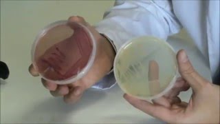 Técnicas básicas de Microbiología Morfología de Escherichia coli en diferentes medios de cultivo [upl. by Theone]