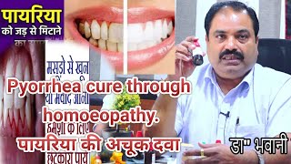 Pyorrhea cure through homoeopathyपायरिया की अचूक दवाDr bhawani Shankar PatnaPyorrhea पायरिया दवा [upl. by Hada793]