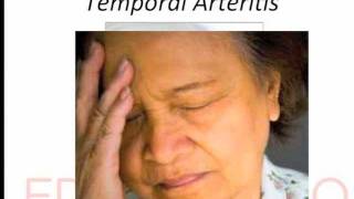 temporal arteritis [upl. by Alonzo]