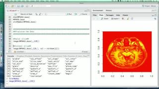 Neuroimaging Analysis in R Image Preprocessing [upl. by Donnell423]