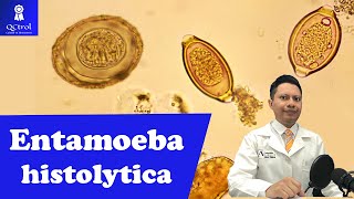 Conoce a Entamoeba histolytica morfología y CLAVES para su identificación🔬 [upl. by Narba598]