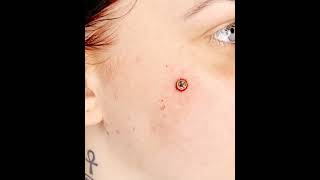 The Piercings Face MicroDermal Piercing by Ferry wwwthepiercingseu  Instathepierc [upl. by Akkimat212]