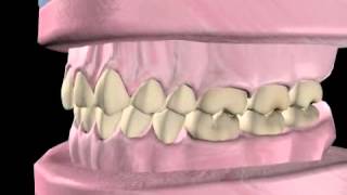 What is Orthodontics [upl. by Neelrahc]