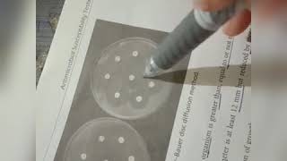 Antimicrobial Susceptibility Testing Microbiology [upl. by Rinaldo]