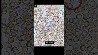 कीटाणु❎White blood cells✅germs bloodline whitebloodcells science biology facts shorts [upl. by Harbird15]