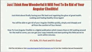 Angular Cheilitis Canesten  Natural Angular Cheilitis Remedy [upl. by Lenrad250]