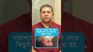 অ্যামনিওসেন্টেসিস কি   Amniocentesis test in pregnancy  Dactar Babu  Ep535 [upl. by Nivlam976]