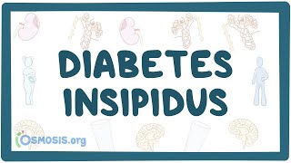 Diabetes insipidus  causes symptoms diagnosis treatment pathology [upl. by Nwahsd94]