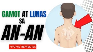 GAMOT at LUNAS sa ANAN  Mga Sanhi Sintomas at Paano Mawawala Home Remedies Creams [upl. by Sirtemed]