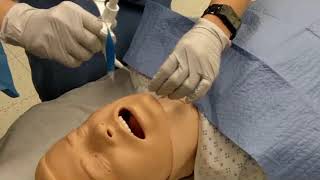 Surgical tracheostomy procedure [upl. by Madelyn]