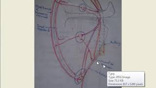 Anastomosis in upper limb around  shoulder amp Elbow [upl. by Dorolice]