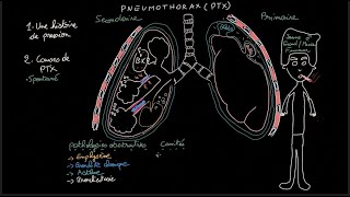 Pneumothorax  Docteur Synapse [upl. by Ssilem]