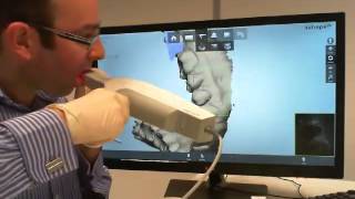 Intra Oral scanning with 3Shape TRIOS [upl. by Angelis839]