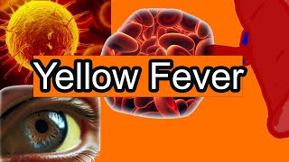 Yellow Fever Explained Simply Symptoms and treatment [upl. by Deehahs]