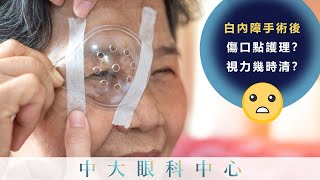 中大眼科 x 港台：做完白內障手術，傷口點護理？視力幾時清？ [upl. by Boar]