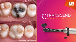 Transcend Universal Composite [upl. by Cardew]