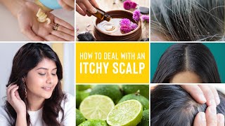 Itchy Scalp Treatments  Remedies For Dandruff Lice and Scalp Acne [upl. by Malha]