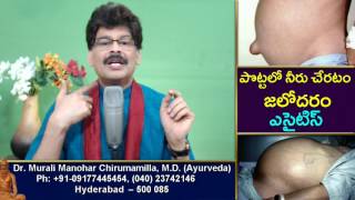 Home Remedies and Ayurvedic Treatment for Ascites Fluid in Abdominal cavity in Telugu by Dr Murai [upl. by Ennovahc]