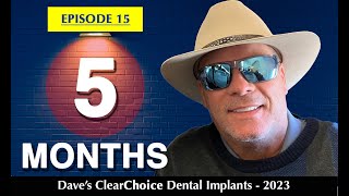 ClearChoice Dental Implants 202324  quot5 MONTHS POST OPquot E15 [upl. by Romilly272]