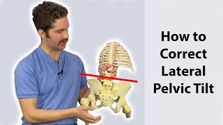 Lateral Pelvic Tilt Correction 4 step guide  Works FAST [upl. by Anirbed]