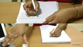 Writers Cramp  Showing dystonic posturing of index finger [upl. by Rodolfo]