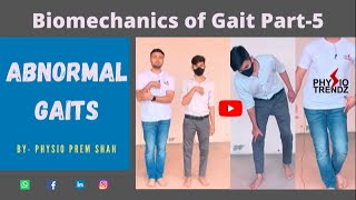 Antalgic gait Hemiplegic gait All Abnormal Gait Demonstration Gait biomechanics [upl. by Nader]