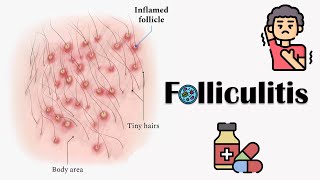 What Is Follicular study  ஃபோலிகுலர் Study என்றால் என்ன [upl. by Gensler455]