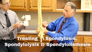 Treating Spondylosis Spondylolysis amp Spondylolisthesis Lumbar Spine [upl. by Sarah]