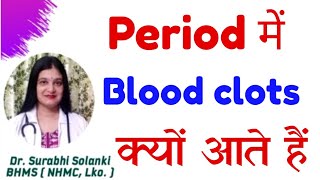 Period me blood clots aana  Period me blood ka thakka aana [upl. by Adidnere]